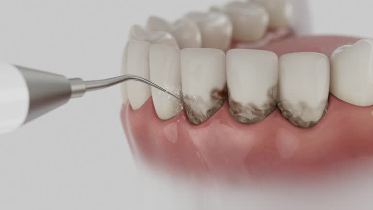 Trusted Teeth Cleaning And Checkup service in Ingram, PA - Dentist Open Now
